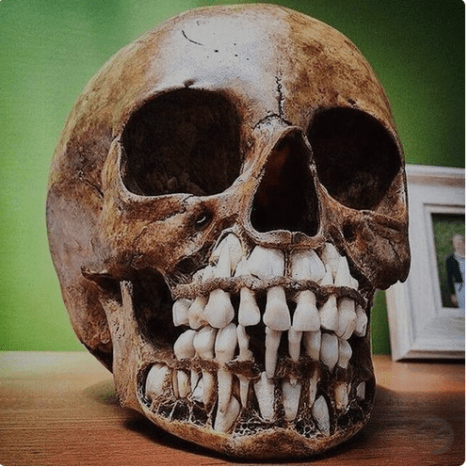 @_Craniac_ felvétele egy gyermek koponyájáról, amelyen minden tejfoga a helyén látható, míg a felnőtt fogak beérkezésükre várnak.