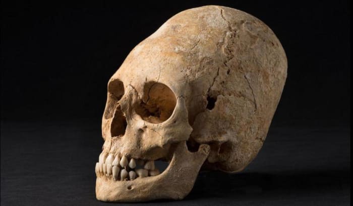 A dél -amerikai törzsek két táblát rögzítenek a csecsemő koponyájára, ami arra kényszeríti a koponyát, hogy hosszúkásan növekedjen.