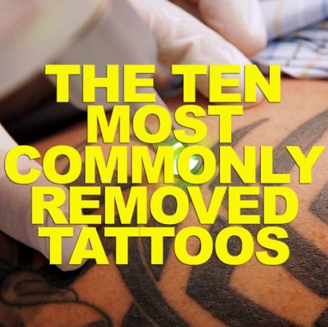 KLIKK HER for å sjekke ut de 10 vanligste tatoveringene som er fjernet!