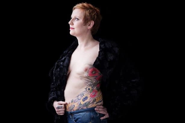 (Foto: Kreftforskning) Etter å ha følt seg selvbevisst om arrene som ble etterlatt etter kampen mot kreft, bestemte Nina Cristinacce seg for å dekke arrene sine med en tatovering. 