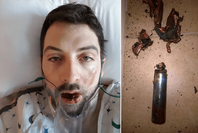 אירוע מתוקשר נוסף של התפוצצות עט-אדים התרחש בינואר 2017, והדף שבעה מתוך שיניו של גבר בן איידהו וחרוך את עורו.