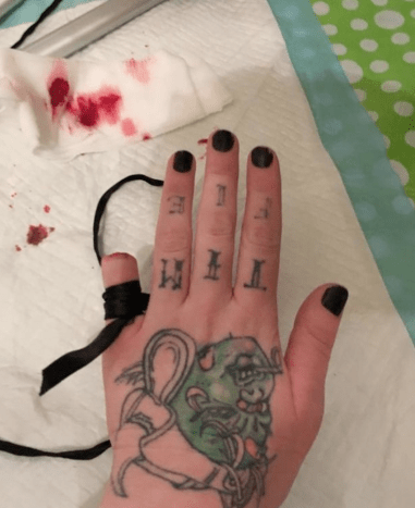 Torz Reynolds finger cut off pinky body mods tattoos