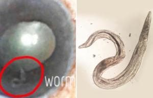 Legene identifiserte raskt synderen som den lange, parasittiske rundormen Dirofilaria. Som vanligvis spres av mygg og er vert for hunder og andre kjøttetere.