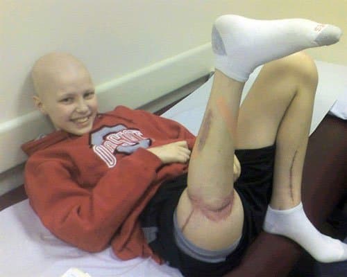 בדוגן סמית 'בן ה -13 אובחן כחולה בסרטן עצם ונאלץ לעבור ניתוח לכריתת קטע מרגלו מהירך ועד הברך. דוגאן החליט לעבור 