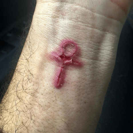 infisert ankh -tatovering på håndleddet