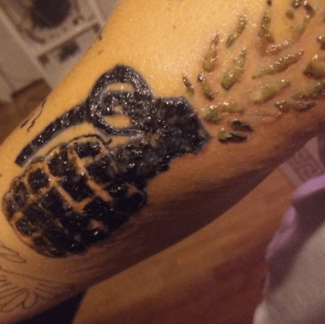 fertőzött gránát tetoválás