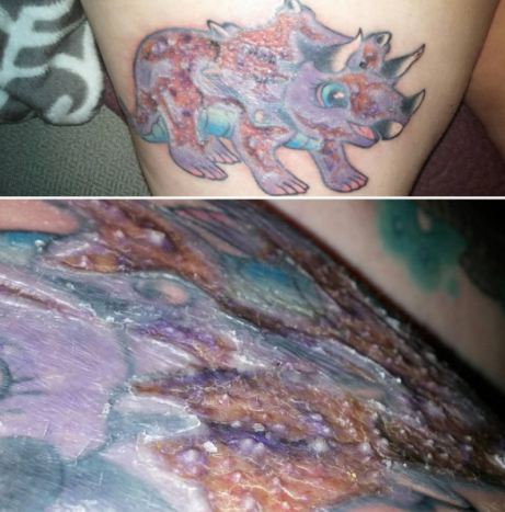 alvorlig infisert dinosaur tatovering
