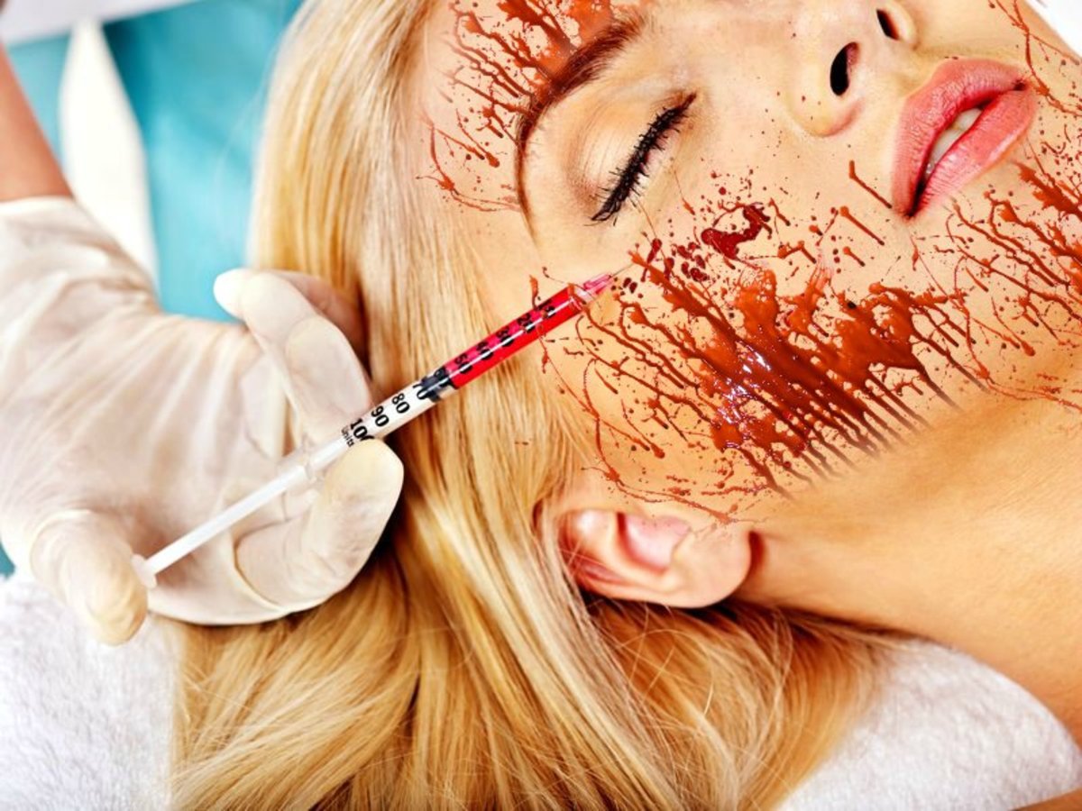 Hva er en vampyr ansiktsbehandling og hva er fordelene med Barbies skjønnhetsbiter