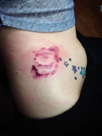 Foto via reddit En fan av Ted Bundy fikk faktisk tatoveret avtrykket av tennene/bittmerkene hennes på hoften. Hun brukte et åstedet for et åstedet til et av ofrene som referanse.