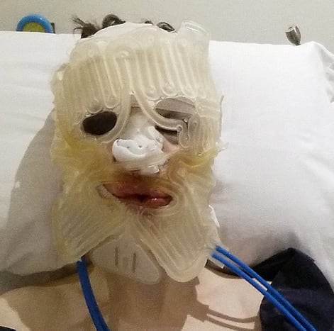 Foto via @missxronix I 2014 gikk Blades under kniven for en ansiktsfeminiseringskirurgi utført i Marbella, Spania.