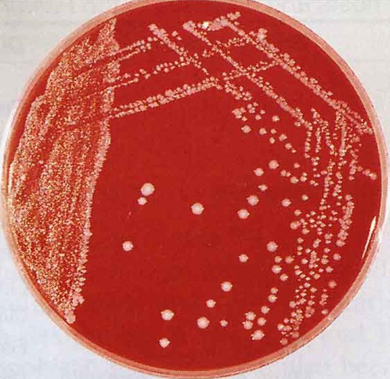 uzročnik bolesti bakterija pasteurella