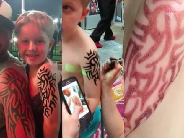 Az Oceanfront Virginia Beach strandján nyaralás közben az ötéves Peyton Knauser édesanyja megengedte neki, hogy készítsen ideiglenes henna tetoválást, hogy illeszkedjen apjához. Néhány nappal később a tinta halványodni kezdett, de ami maradt, az fájdalmas vörös, hólyagos bőr volt.