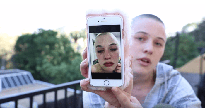 Riley Nixon egy pornósztár és a 2017. márciusi Penthouse Pet. A videóban egy olyan élményt mesél el újra, amely megdöbbentően hasonlít Hollóéhoz, és még egy fotót is közöl az arcán lévő törött erekről a forgatás után.