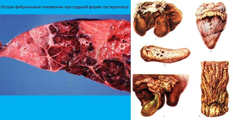 oštećenje unutarnjih organa