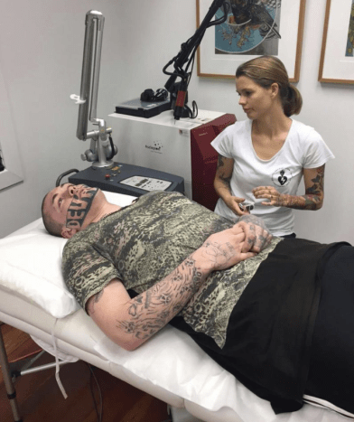 Foto via au.newsBriar Neville -eier av Sacred Laser som tilbød gratis laserfjerning, kommenterte den potensielle vanskeligheten ved å fjerne Cropps tatovering: 