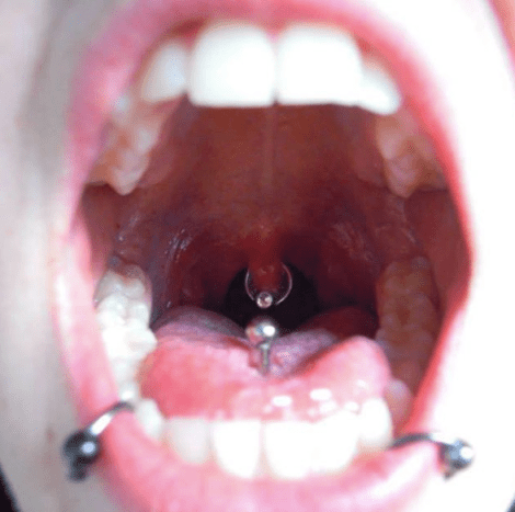 sprø piercing i munnen