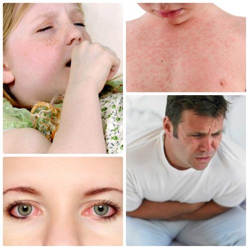 allergie symptomen