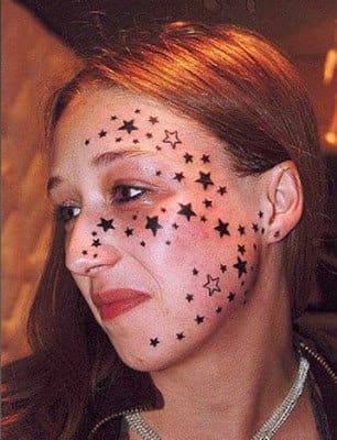 Kimberley Vlaminck végül eltávolította az arca bal oldalán lévő 56 csillagot.